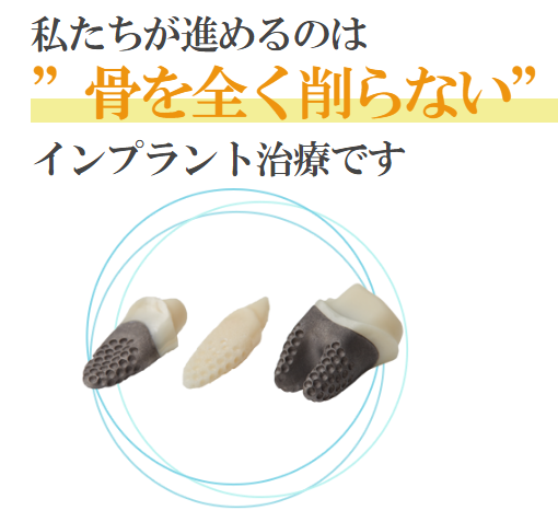 《　外科治療オーダーメイドインプラント　》
当院ではインプラントの経験豊富な歯科医師が多く在籍しております。新しく抜歯直後に埋入可能なオーダーメイドインプラント治療を導入いたしました。